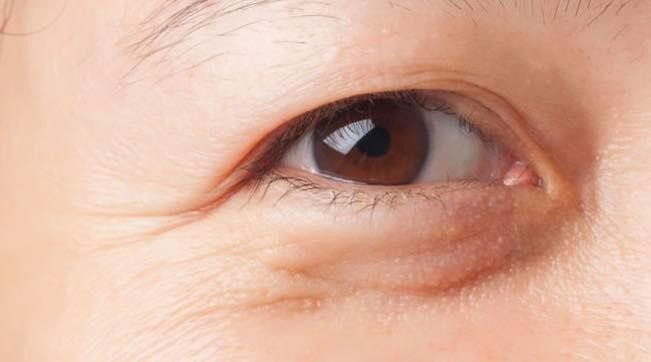 giải pháp trẻ hóa vùng mắt - https://thammyvientrucmai.com/